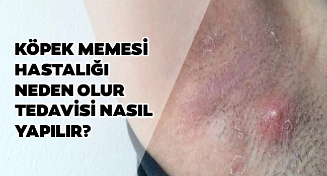 köpek memesi hastalığı