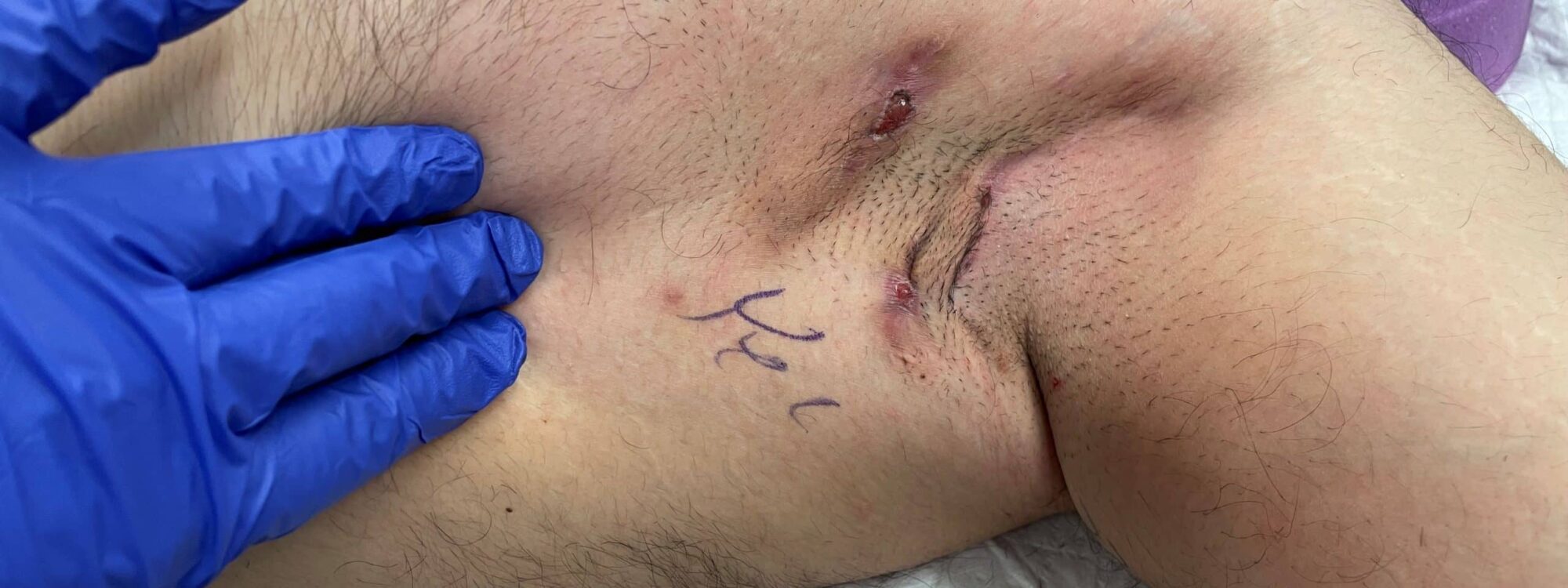 kopek-memesi-hastaligi-1