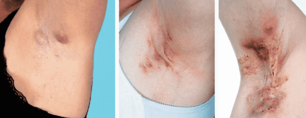 kopek-memesi-hastaligi-2