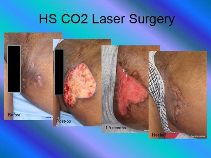 kopek-memesi-hastaligi-3